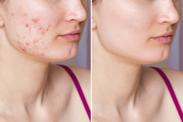 Comparison Image for skin-care - 1