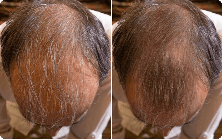 Comparison Image for hair-care - 1
