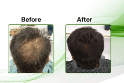 Comparison Image for hair-care - 4