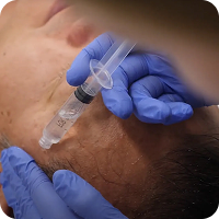 Exosome Therapy Service